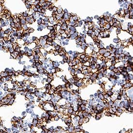 Pref-1/DLK1/FA1 was detected in immersion fixed frozen sections of mouse embryonic liver tissue (13 d.p.c.) using Rabbit Anti-Mouse Pref-1/DLK1/FA1 Monoclonal Antibody (Catalog # MAB8634) at 1 µg/mL for 1 hour at room temperature followed by incubation with the Anti-Rabbit IgG VisUCyte™ HRP Polymer Antibody (Catalog # VC003). Tissue was stained using DAB (brown) and counterstained with hematoxylin (blue). Specific staining was localized to plasma membrane. View our protocol for IHC Staining with VisUCyte HRP Polymer Detection Reagents.