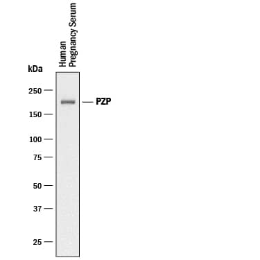Western Blot Pregnancy Zone Protein Antibody