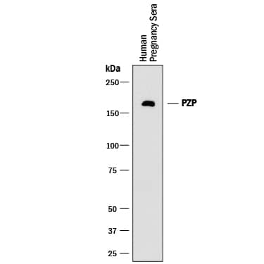 Western Blot Pregnancy Zone Protein Antibody (909813) [Unconjugated]