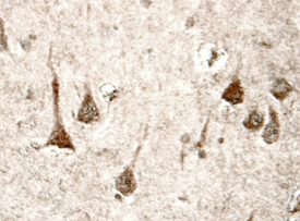 Presenilin-1 was detected in immersion fixed paraffin-embedded sections of human brain (hippocampus) using 15 µg/mL Goat Anti-Human Presenilin-1 N-Terminal Frag-ment Antigen Affinity-purified Polyclonal Antibody (Catalog # AF149) overnight at 4 °C. Tissue was stained with the Anti-Goat HRP-DAB Cell & Tissue Staining Kit (brown; Catalog # CTS008) and counterstained with hematoxylin (blue). View our protocol for Chromogenic IHC Staining of Paraffin-embedded Tissue Sections.
