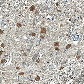 Presenilin-1 was detected in immersion fixed paraffin-embedded sections of human brain (medulla) using Mouse Anti-Human Presenilin-1 N-Terminal Fragment Monoclonal Antibody (Catalog # MAB149) at 1.7 µg/mL for 1 hour at room temperature followed by incubation with the Anti-Mouse IgG VisUCyte™ HRP Polymer Antibody (Catalog # VC001). Tissue was stained using DAB (brown) and counterstained with hematoxylin (blue). Specific staining was localized to neuronal cell bodies. View our protocol for IHC Staining with VisUCyte HRP Polymer Detection Reagents.