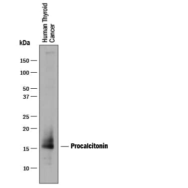 Western blot shows lysates of human thyroid cancer tissue. PVDF membrane was probed with 1 µg/mL of Sheep Anti-Human Procalcitonin Antigen Affinity-purified Polyclonal Antibody (Catalog # AF8350) followed by HRP-conjugated Anti-Sheep IgG Secondary Antibody (Catalog # HAF016). A specific band was detected for Procalcitonin at approximately 15-16 kDa (as indicated). This experiment was conducted under reducing conditions and using Immunoblot Buffer Group 1.