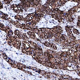 Immunohistochemistry Procalcitonin Antibody (944002) [Unconjugated]