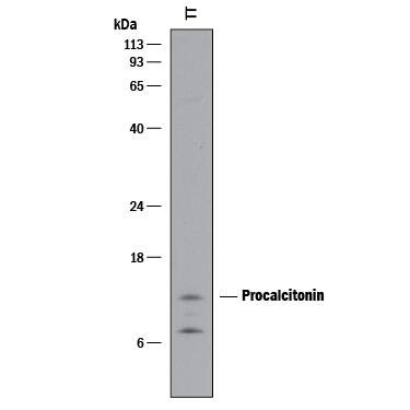 Western Blot Procalcitonin Antibody (944002) [Unconjugated]