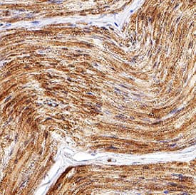 CGRP was detected in immersion fixed paraffin-embedded sections of human dorsal root ganglion using Rabbit Anti-Human CGRP Monoclonal Antibody (Catalog # MAB83503) at 3 µg/mL for 1 hour at room temperature followed by incubation with the Anti-Rabbit IgG VisUCyte™ HRP Polymer Antibody (VC003). Before incubation with the primary antibody, tissue was subjected to heat-induced epitope retrieval using Antigen Retrieval Reagent-Basic (CTS013). Tissue was stained using DAB (brown) and counterstained with hematoxylin (blue). Specific staining was localized to cytoplasm. View our protocol for IHC Staining with VisUCyte HRP Polymer Detection Reagents.