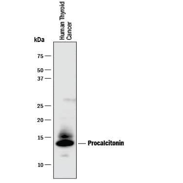 Western blot shows lysates of human thyroid cancer tissue. PVDF membrane was probed with 1 µg/mL of Mouse Anti-Human Procalcitonin Monoclonal Antibody (Catalog # MAB8350) followed by HRP-conjugated Anti-Mouse IgG Secondary Antibody (Catalog # HAF018). A specific band was detected for Procalcitonin at approximately 15 kDa (as indicated). This experiment was conducted under reducing conditions and using Immunoblot Buffer Group 1.