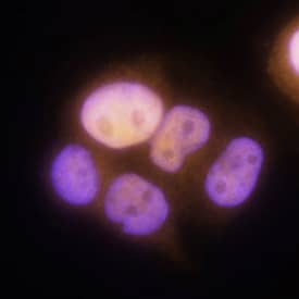 Immunocytochemistry Progesterone R/NR3C3 Antibody [Unconjugated]