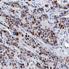 Immunohistochemistry Progesterone R/NR3C3 Antibody [Unconjugated]