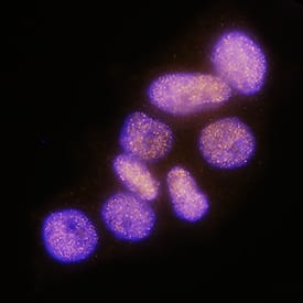 Progesterone R B/NR3C3 was detected in immersion fixed T47D human breast cancer cell line using Mouse Anti-Human Progesterone R B/NR3C3 Monoclonal Antibody (Catalog # MAB5886) at 3 µg/mL for 3 hours at room temperature. Cells were stained using the NorthernLights™ 557-conjugated Anti-Mouse IgG Secondary Antibody (red; Catalog # NL007) and counterstained with DAPI (blue). Specific staining was localized to nuclei. View our protocol for Fluorescent ICC Staining of Cells on Coverslips.