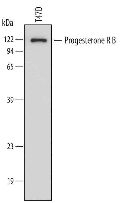 Western blot shows lysates of T47D human breast cancer cell line. PVDF membrane was probed with 1 µg/mL of Mouse Anti-Human Progesterone R B/NR3C3 Monoclonal Antibody (Catalog # MAB5886) followed by HRP-conjugated Anti-Mouse IgG Secondary Antibody (Catalog # HAF007). A specific band was detected for Progesterone R B/NR3C3 at approximately 118 kDa (as indicated). This experiment was conducted under reducing conditions and using Immunoblot Buffer Group 3.