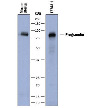 Western blot shows lysates of mouse uterus tissue and J774A.1 mouse reticulum cell sarcoma macrophage cell line. PVDF membrane was probed with 0.5 µg/mL of Sheep Anti-Mouse Progranulin/PGRN Antigen Affinity-purified Polyclonal Antibody (Catalog # AF2557) followed by HRP-conjugated Anti-Sheep IgG Secondary Antibody (Catalog # HAF016). A specific band was detected for Progranulin/PGRN at approximately 85-90 kDa (as indicated). This experiment was conducted under reducing conditions and using Immunoblot Buffer Group 1.
