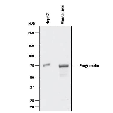 Western blot shows lysates of HepG2 human hepatocellular carcinoma cell line and mouse liver tissue. PVDF membrane was probed with 2 µg/mL of Mouse Anti-Human Progranulin/PGRN Polyclonal Antibody (Catalog # MAB24201) followed by HRP-conjugated Anti-Mouse IgG Secondary Antibody (Catalog # HAF018). A specific band was detected for Progranulin/PGRN at approximately 75 kDa (as indicated). This experiment was conducted under reducing conditions and using Immunoblot Buffer Group 1. For Western blotting, Catalog # AF2420is recommended.