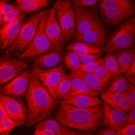 Prohibitin was detected in immersion fixed MCF-7 human breast cancer cell line using Goat Anti-Human Prohibitin Antigen Affinity-purified Polyclonal Antibody (Catalog # AF3470) at 10 µg/mL for 3 hours at room temperature. Cells were stained using the NorthernLights™ 557-conjugated Anti-Goat IgG Secondary Antibody (red; Catalog # NL001) and counterstained with DAPI (blue). Specific staining was localized to cytoplasm. View our protocol for Fluorescent ICC Staining of Cells on Coverslips.