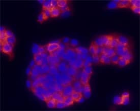 Proinsulin was detected in immersion fixed beta TC-6 mouse beta cell insulinoma cell line using Mouse Anti-Human/Mouse Proinsulin Monoclonal Antibody (Catalog # MAB13361) at 10 µg/mL for 3 hours at room temperature. Cells were stained using the NorthernLights™ 557-conjugated Anti-Mouse IgG Secondary Antibody (red; Catalog # NL007) and counterstained with DAPI (blue). Specific staining was localized to cytoplasm. View our protocol for Fluorescent ICC Staining of Cells on Coverslips.