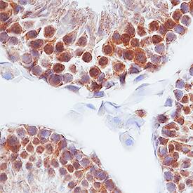 Prolactin was detected in immersion fixed paraffin-embedded sections of human testis using Goat Anti-Human Prolactin Antigen Affinity-purified Polyclonal Antibody (Catalog # AF682) at 1 µg/mL overnight at 4 °C. Tissue was stained using the Anti-Goat HRP-DAB Cell & Tissue Staining Kit (brown; Catalog # CTS008) and counterstained with hematoxylin (blue). Specific staining was localized to cytoplasm of sperm cells. View our protocol for Chromogenic IHC Staining of Paraffin-embedded Tissue Sections.