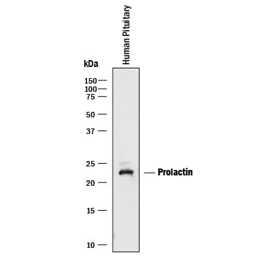 Western blot shows lysates of human pituitary tissue. PVDF membrane was probed with 0.25 µg/mL of Goat Anti-Human Prolactin Antigen Affinity-purified Polyclonal Antibody (Catalog # AF682) followed by HRP-conjugated Anti-Goat IgG Secondary Antibody (Catalog # HAF017). A specific band was detected for Prolactin at approximately 23 kDa (as indicated). This experiment was conducted under reducing conditions and using Immunoblot Buffer Group 1.