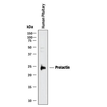 Western blot shows lysate of human pituitary tissue. PVDF membrane was probed with 1 µg/mL of Mouse Anti-Human Prolactin Monoclonal Antibody (Catalog # MAB6821) followed by HRP-conjugated Anti-Mouse IgG Secondary Antibody (Catalog # HAF018). A specific band was detected for Prolactin at approximately 23 kDa (as indicated). This experiment was conducted under reducing conditions and using Immunoblot Buffer Group 1.