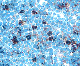 Prolactin R was detected in perfusion fixed frozen sections of rat thymus using Goat Anti-Rat Prolactin R Antigen Affinity-purified Polyclonal Antibody (Catalog # AF1112) at 15 &micro;g/mL overnight at 4 &deg;C. Tissue was stained using the Anti-Goat HRP-DAB Cell & Tissue Staining Kit (brown; Catalog # CTS008) and counterstained with hematoxylin (blue). Specific labeling was localized to the cytoplasm of lymphocytes. View our protocol for Chromogenic IHC Staining of Frozen Tissue Sections.