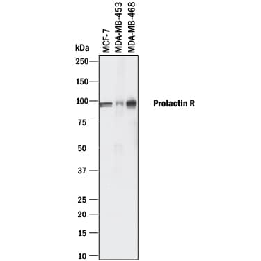 Western Blot Prolactin R Antibody [Unconjugated]