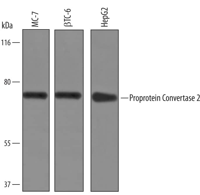 Western Blot Proprotein Convertase 2/PCSK2 Antibody