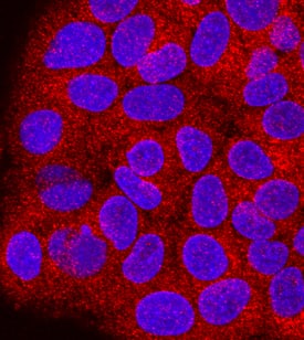 Proprotein Convertase 2/ PCSK2 was detected in immersion fixed HepG2 human hepatocellular carcinoma cell line using Mouse Anti-Human Proprotein Convertase 2/ PCSK2 Monoclonal Antibody (Catalog # MAB6018) at 10 µg/mL for 3 hours at room temperature. Cells were stained using the NorthernLights™ 557-conjugated Anti-Mouse IgG Secondary Antibody (red; Catalog # NL007) and counterstained with DAPI (blue). View our protocol for Fluorescent ICC Staining of Cells on Coverslips.