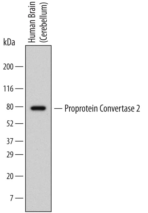 Western blot shows lysates of human brain (cerebellum) tissue. PVDF Membrane was probed with 2 µg/mL of Human Proprotein Convertase 2/PCSK2 Monoclonal Antibody (Catalog # MAB6018) followed by HRP-conjugated Anti-Mouse IgG Secondary Antibody (Catalog # HAF007). A specific band was detected for Proprotein Convertase 2/PCSK2 at approximately 75 kDa (as indicated). This experiment was conducted under reducing conditions and using Immunoblot Buffer Group 1.