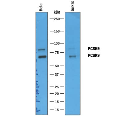 Western blot shows lysates of HeLa human cervical epithelial carcinoma cell line and Jurkat human acute T cell leukemia cell line. PVDF membrane was probed with 1 µg/mL of Sheep Anti-Human Proprotein Convertase 9/PCSK9 Antigen Affinity-purified Polyclonal Antibody (Catalog # AF3888) followed by HRP-conjugated Anti-Sheep IgG Secondary Antibody (Catalog # HAF016). A specific band was detected for Pre-Proprotein Convertase 9/PCSK9 at approximately 80 kDa and mature Proprotein Convertase 9/PCSK9 60 kDa (as indicated). This experiment was conducted under reducing conditions and using Immunoblot Buffer Group 1.