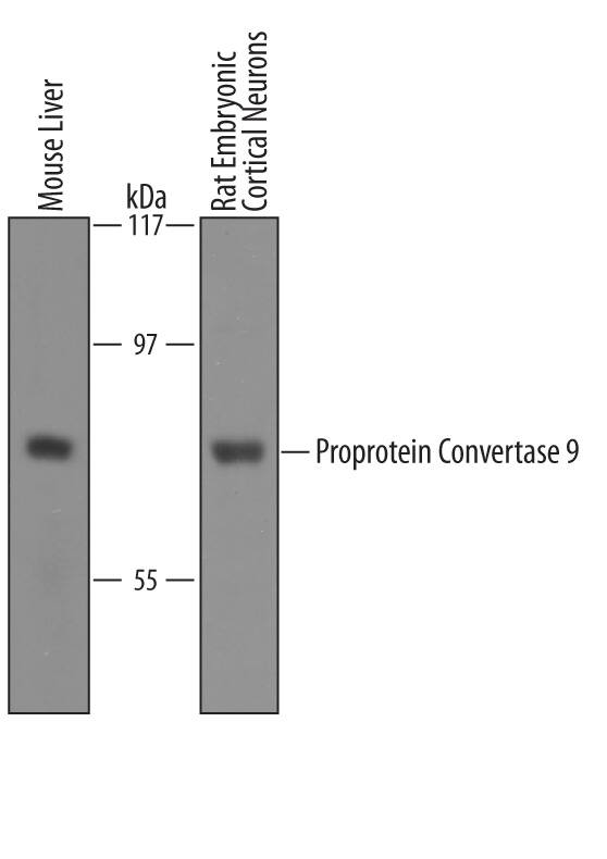 Western blot shows lysates of mouse liver tissue and rat embryonic cortical neuron. PVDF Membrane was probed with 1 µg/mL of Goat Anti-Mouse/Rat Proprotein Convertase 9/PCSK9 Antigen Affinity-purified Polyclonal Antibody (Catalog # AF3985) followed by HRP-conjugated Anti-Goat IgG Secondary Antibody (Catalog # HAF019). A specific band was detected for Proprotein Convertase 9/PCSK9 at approximately 74 kDa (as indicated). This experiment was conducted under reducing conditions and using Immunoblot Buffer Group 7.