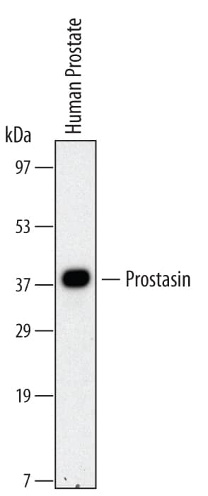 Western Blot Prostasin/Prss8 Antibody (530622)
