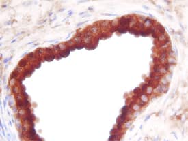 Prostatic Acid Phosphatase/ACPP was detected in immersion fixed paraffin-embedded sections of human prostate using Human Prostatic Acid Phosphatase/ACPP Antigen Affinity-purified Polyclonal Antibody (Catalog # AF6240) at 3 µg/mL overnight at 4 °C. Before incubation with the primary antibody, tissue was subjected to heat-induced epitope retrieval using Antigen Retrieval Reagent-Basic (Catalog # CTS013). Tissue was stained using the Anti-Sheep HRP-DAB Cell & Tissue Staining Kit (brown; Catalog # CTS019) and counterstained with hemotoxylin (blue). Specific staining was localized to the cytoplasm of epithelial cells. View our protocol for Chromogenic IHC Staining of Paraffin-embedded Tissue Sections.