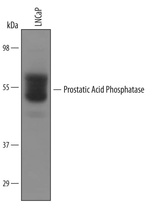 Western blot shows lysates of LNCaP human prostate cancer cell line. PVDF Membrane was probed with 1 µg/mL of Human Prostatic Acid Phosphatase/ACPP Antigen Affinity-purified Polyclonal Antibody (Catalog # AF6240) followed by HRP-conjugated Anti-Sheep IgG Secondary Antibody (Catalog # HAF016). A specific band was detected for Prostatic Acid Phosphatase/ACPP at approximately 50-55 kDa (as indicated). This experiment was conducted under reducing conditions and using Immunoblot Buffer Group 8.