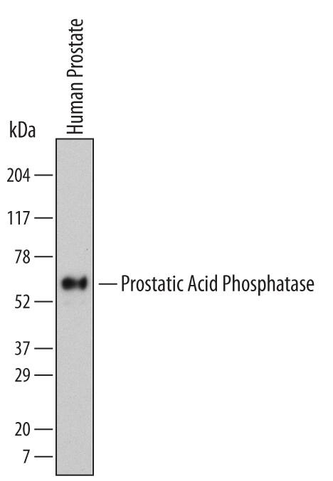 Western blot shows lysates of human prostate tissue. PVDF Membrane was probed with 2 µg/mL of Human Prostatic Acid Phosphatase/ACPP Monoclonal Antibody (Catalog # MAB6240) followed by HRP-conjugated Anti-Mouse IgG Secondary Antibody (Catalog # HAF007). A specific band was detected for Prostatic Acid Phosphatase/ACPP at approximately 55 kDa (as indicated). This experiment was conducted under reducing conditions and using Immunoblot Buffer Group 1.