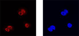 Prox1 was detected in immersion fixed HepG2 human hepatocellular carcinoma cell line using Goat Anti-Human Prox1 Antigen Affinity-purified Polyclonal Antibody (Catalog # AF2727) at 15 µg/mL for 3 hours at room temperature. Cells were stained using the NorthernLights™ 557-conjugated Anti-Goat IgG Secondary Antibody (left panel, red; Catalog # NL001) and counterstained with DAPI (right panel, blue). Specific staining was localized to nuclei. View our protocol for Fluorescent ICC Staining of Cells on Coverslips.