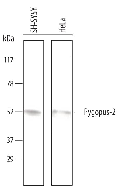 Western blot shows lysates of SH-SY5Y human neuroblastoma cell line and HeLa human cervical epithelial carcinoma cell line. PVDF Membrane was probed with 1 µg/mL of Goat Anti-Human Pygopus-2 Antigen Affinity-purified Polyclonal Antibody (Catalog # AF3616) followed by HRP-conjugated Anti-Goat IgG Secondary Antibody (Catalog # HAF109). A specific band was detected for Pygopus-2 at approximately 53 kDa (as indicated). This experiment was conducted under reducing conditions and using Immunoblot Buffer Group 8.