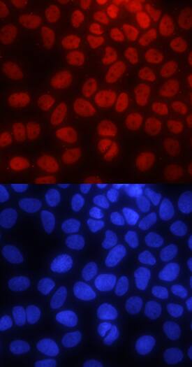 Pygopus-2 was detected in immersion fixed MCF-7 human breast cancer cell line using Mouse Anti-Human Pygopus-2 Monoclonal Antibody (Catalog # MAB3616) at 10 µg/mL for 3 hours at room temperature. Cells were stained using the NorthernLights™ 557-conjugated Anti-Mouse IgG Secondary Antibody (red, upper panel; Catalog # NL007) and counterstained with DAPI (blue, lower panel). Specific staining was localized to nuclei. View our protocol for Fluorescent ICC Staining of Cells on Coverslips.