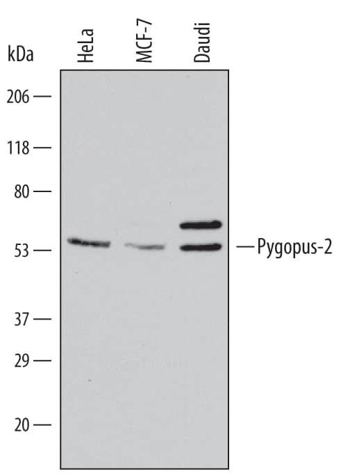 Western Blot Pygopus-2 Antibody (539730) [Unconjugated]