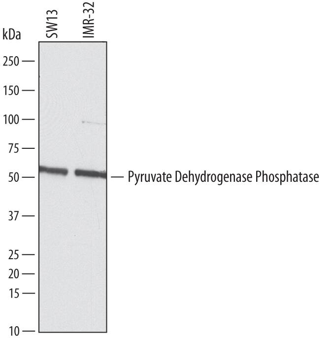 Western Blot Pyruvate Dehydrogenase Phosphatase/PDP1/PPM2C Antibody