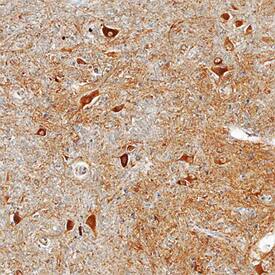 Glutaminyl-peptide Cyclotransferase/QPCT was detected in immersion fixed paraffin-embedded sections of human brain using Sheep Anti-Human Glutaminyl-peptide Cyclotransferase/QPCT Antigen Affinity-purified Polyclonal Antibody (Catalog # AF6368) at 3 µg/mL overnight at 4 °C. Before incubation with the primary antibody, tissue was subjected to heat-induced epitope retrieval using Antigen Retrieval Reagent-Basic (Catalog # CTS013). Tissue was stained using the Anti-Sheep HRP-DAB Cell & Tissue Staining Kit (brown; Catalog # CTS019) and counterstained with hematoxylin (blue). Specific staining was localized to neuronal cell bodies and processes. View our protocol for Chromogenic IHC Staining of Paraffin-embedded Tissue Sections.