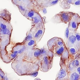 RAGE was detected in immersion fixed paraffin-embedded sections of human lung using Goat Anti-Human/Mouse/Rat RAGE Antigen Affinity-purified Polyclonal Antibody (Catalog # AF1145) at 0.5 µg/mL for 1 hour at room temperature followed by incubation with the Anti-Goat IgG VisUCyte™ HRP Polymer Antibody (Catalog # VC004). Tissue was stained using DAB (brown) and counterstained with hematoxylin (blue). Specific staining was localized to cell membranes. View our protocol for IHC Staining with VisUCyte HRP Polymer Detection Reagents.