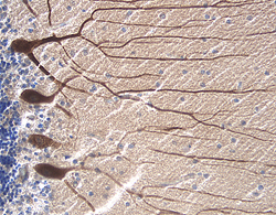 RAGE was detected in immersion fixed paraffin-embedded sections of human Alzheimer's disease brain (cerebellum) using 15 µg/mL Goat Anti-Human/Mouse/Rat RAGE Antigen Affinity-purified Polyclonal Antibody (Catalog # AF1145) overnight at 4 °C. Tissue was stained with the Anti-Goat HRP-DAB Cell & Tissue Staining Kit (brown; Catalog # CTS008) and counterstained with hematoxylin (blue). View our protocol for Chromogenic IHC Staining of Paraffin-embedded Tissue Sections.
