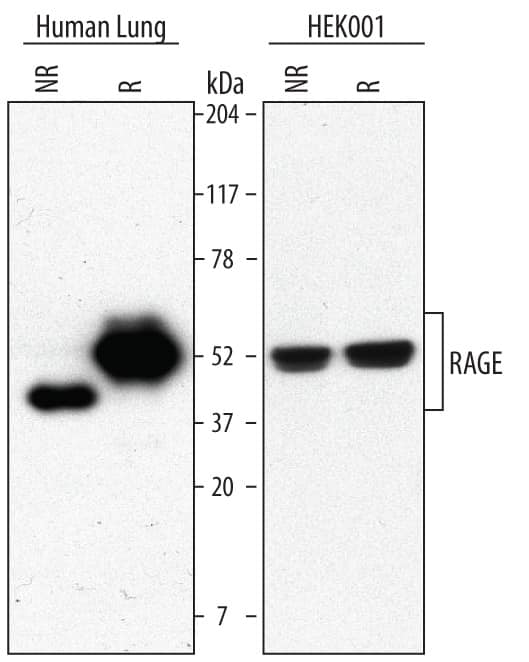 Western blot shows lysates of human lung tissue and HEK001 human epidermal keratinocyte cell line. PVDF Membrane was probed with 1 µg/mL of Goat Anti-Human/Mouse/Rat RAGE Antigen Affinity-purified Polyclonal Antibody (Catalog # AF1145) followed by HRP-conjugated Anti-Goat IgG Secondary Antibody (Catalog # HAF017). Specific bands were detected for RAGE at approximately 43 kDa under non-reducing (NR) conditions and 50 kDa under reducing (R) conditions (as indicated). This experiment was conducted using Immunoblot Buffer Group 5.