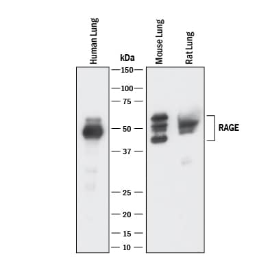Western blot shows lysates of human, mouse, and rat lung tissue. PVDF membrane was probed with 1 µg/mL of Goat Anti-Human/Mouse/Rat RAGE Antigen Affinity-purified Polyclonal Antibody (Catalog # AF1145) followed by HRP-conjugated Anti-Goat IgG Secondary Antibody (Catalog # HAF017). Specific bands were detected for RAGE at approximately 45-55 kDa (as indicated). This experiment was conducted under reducing conditions and using Immunoblot Buffer Group 1.
