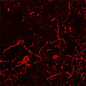 RAGE was detected in immersion fixed frozen sections of mouse brain using Goat Anti-Mouse/Rat RAGE Antigen Affinity-purified Polyclonal Antibody (Catalog # AF1179) at 15 µg/mL overnight at 4 °C. Tissue was stained using the NorthernLights™ 557-conjugated Anti-Goat IgG Secondary Antibody (red; Catalog # NL001) and counterstained with DAPI (blue). Specific staining was localized to neurons. View our protocol for Fluorescent IHC Staining of Frozen Tissue Sections.