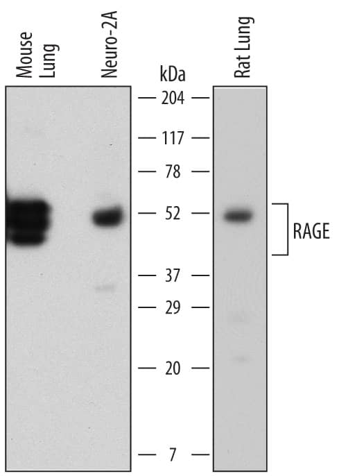 Western blot shows lysates of mouse lung tissue, Neuro-2A mouse neuroblastoma cell line, and rat lung tissue. PVDF membrane was probed with 1 µg/mL of Rat Anti-Mouse RAGE Monoclonal Antibody (Catalog # MAB11795) followed by HRP-conjugated Anti-Rat IgG Secondary Antibody (HAF005). Specific bands were detected for RAGE at approximately 45 to 50 kDa (as indicated). This experiment was conducted under reducing conditions and using Immunoblot Buffer Group 1.