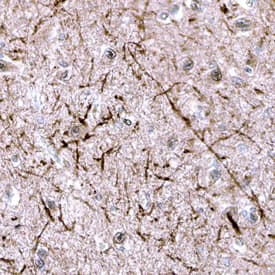 Immunohistochemistry RAMP1 Antibody [Unconjugated]