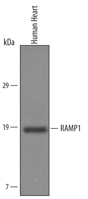 Western Blot RAMP1 Antibody [Unconjugated]