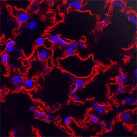 Immunohistochemistry RAMP2 Antibody (773816) [Unconjugated]