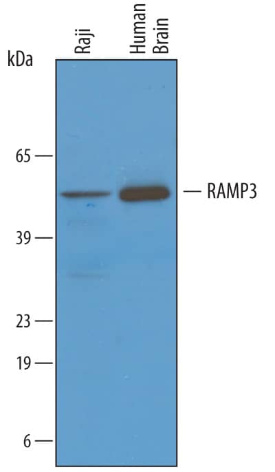Western Blot RAMP3 Antibody