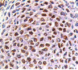 RANK/TNFRSF11A was detected in immersion fixed frozen sections of rat embryo (cartillage primordium, 7 days p.c.) using 10 &micro;g/mL Goat Anti-Mouse RANK/TNFRSF11A Antigen Affinity-purified Polyclonal Antibody (Catalog # AF692) overnight at 4 &deg;C. Before incubation with the primary antibody tissue was subjected to heat-induced epitope retrieval using Antigen Retrieval Reagent-Basic (Catalog # CTS013). Tissue was stained with the Anti-Goat HRP-DAB Cell & Tissue Staining Kit (brown; Catalog # CTS008) and counterstained with hematoxylin (blue). View our protocol for Chromogenic IHC Staining of Frozen Tissue Sections.