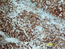 RANK/TNFRSF11A was detected in immersion fixed paraffin-embedded sections of human liver using Mouse Anti-Human RANK/TNFRSF11A Monoclonal Antibody (Catalog # MAB6831) at 25 µg/mL overnight at 4 °C. Tissue was stained using the Anti-Mouse HRP-DAB Cell & Tissue Staining Kit (brown; Catalog # CTS002) and counterstained with hematoxylin (blue). View our protocol for Chromogenic IHC Staining of Paraffin-embedded Tissue Sections.